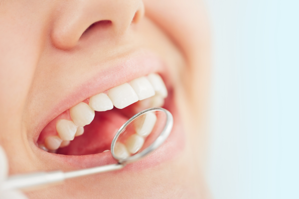 checking teeth with a small mirror