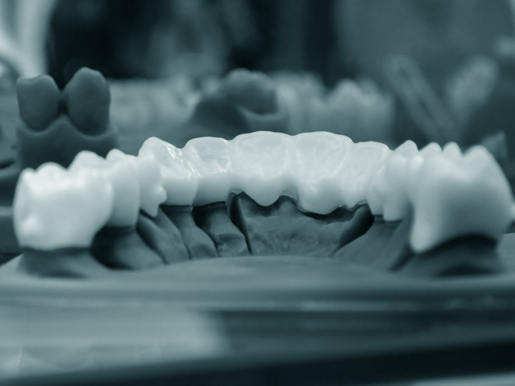 3D printed teeth