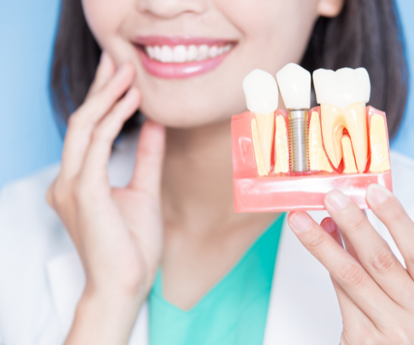 woman holding fake model of dental implant surgery